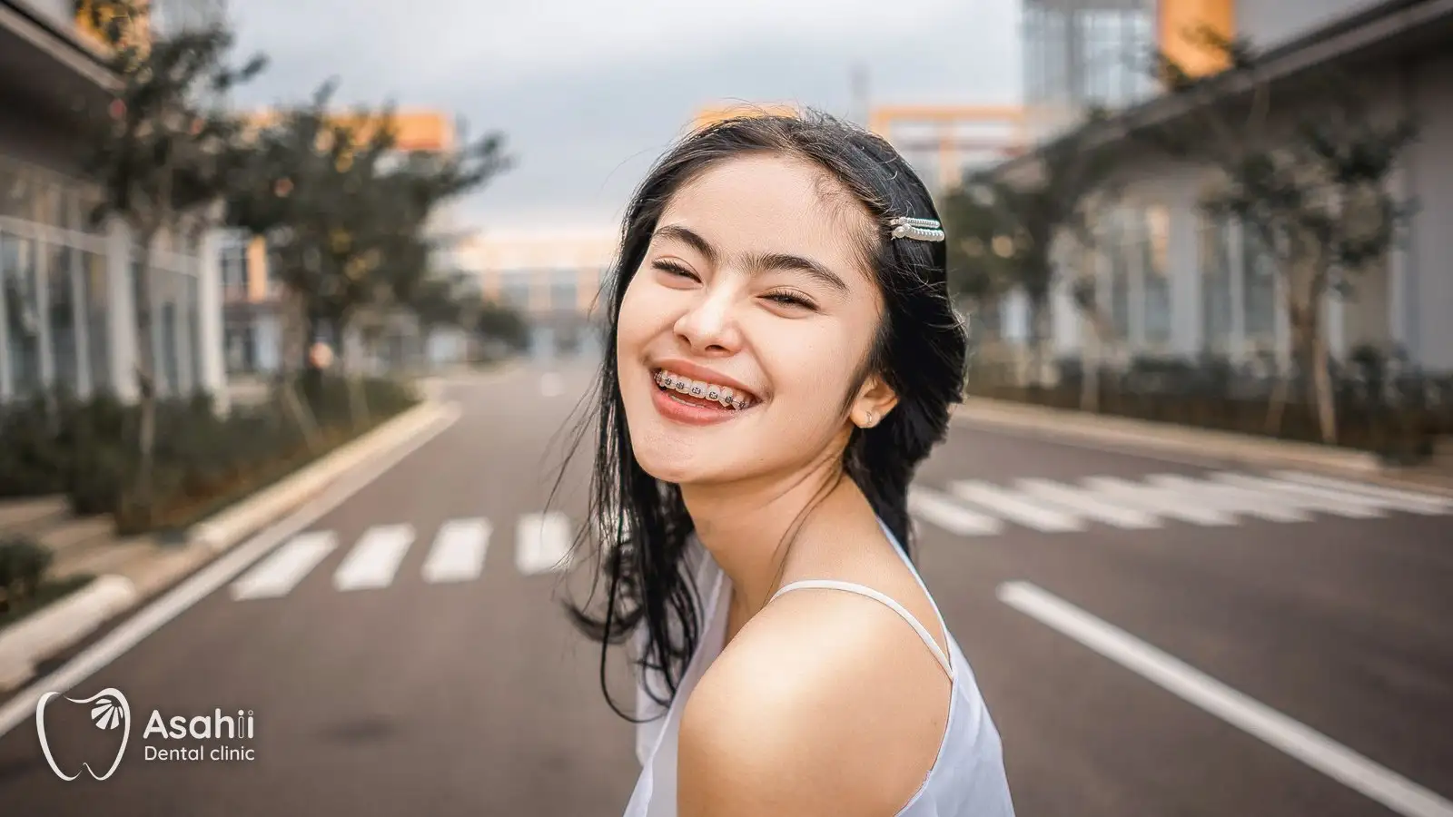 A smile with braces: metal brackets, ceramic brackets and clear aligners each have their own strengths