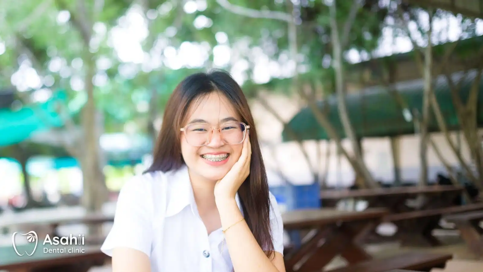 Niềng răng không phải lúc nào cũng cần nhổ răng — quyết định dựa trên phim và phân tích khớp cắn