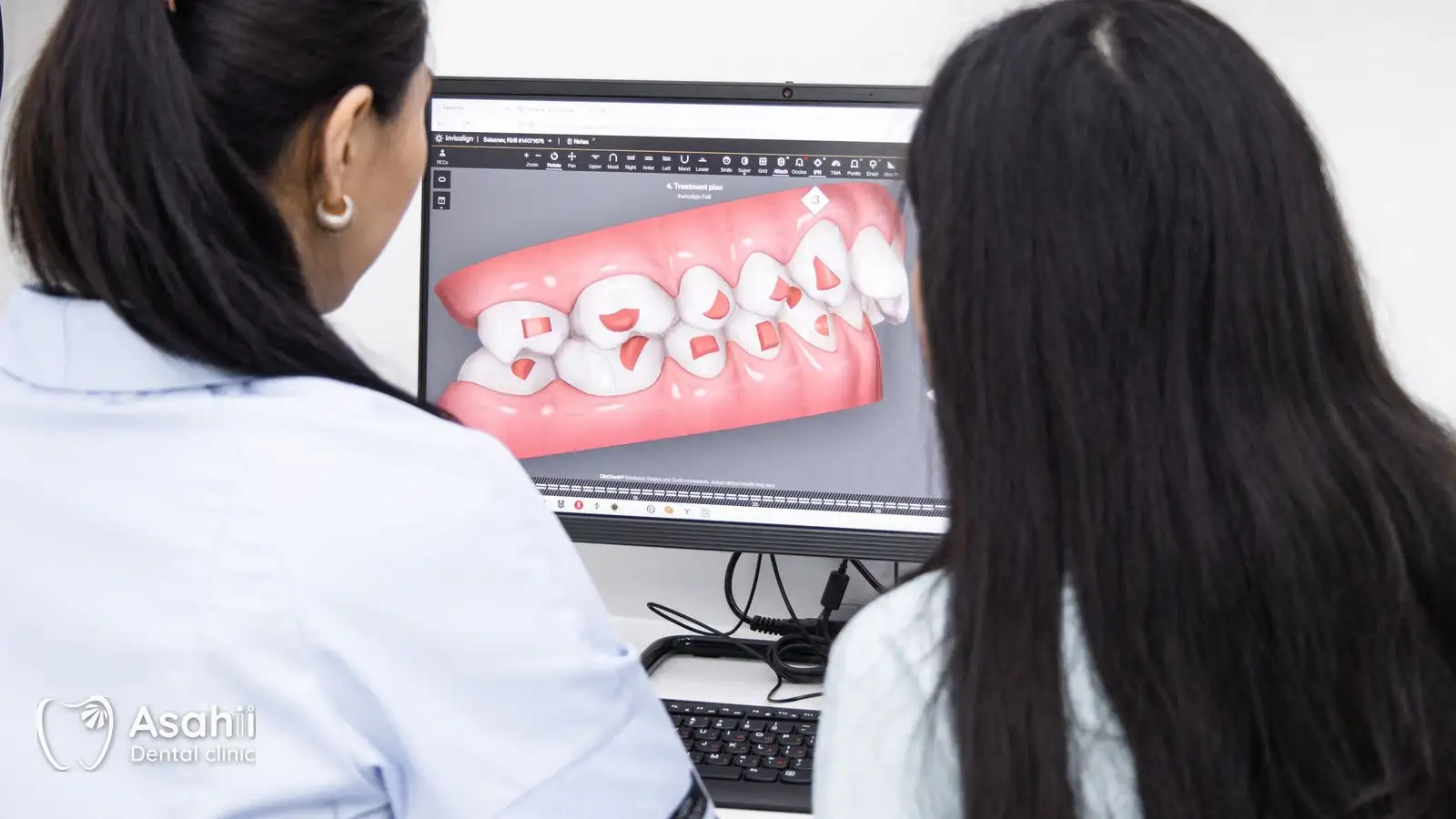 Một buổi tư vấn chỉnh nha tốt có phim, ảnh và mô phỏng để cha mẹ hiểu kế hoạch trước khi quyết định