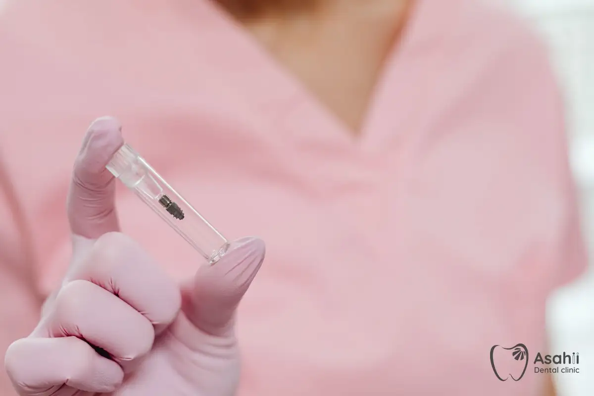 An implant in its sterile tube, ready to be placed in the jawbone