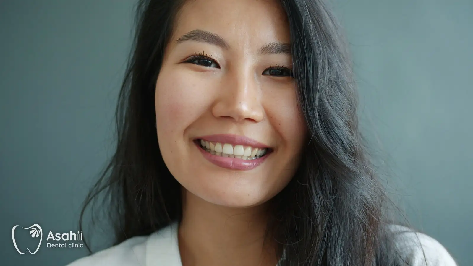 A bright, even smile: whitening suits healthy teeth that have become stained