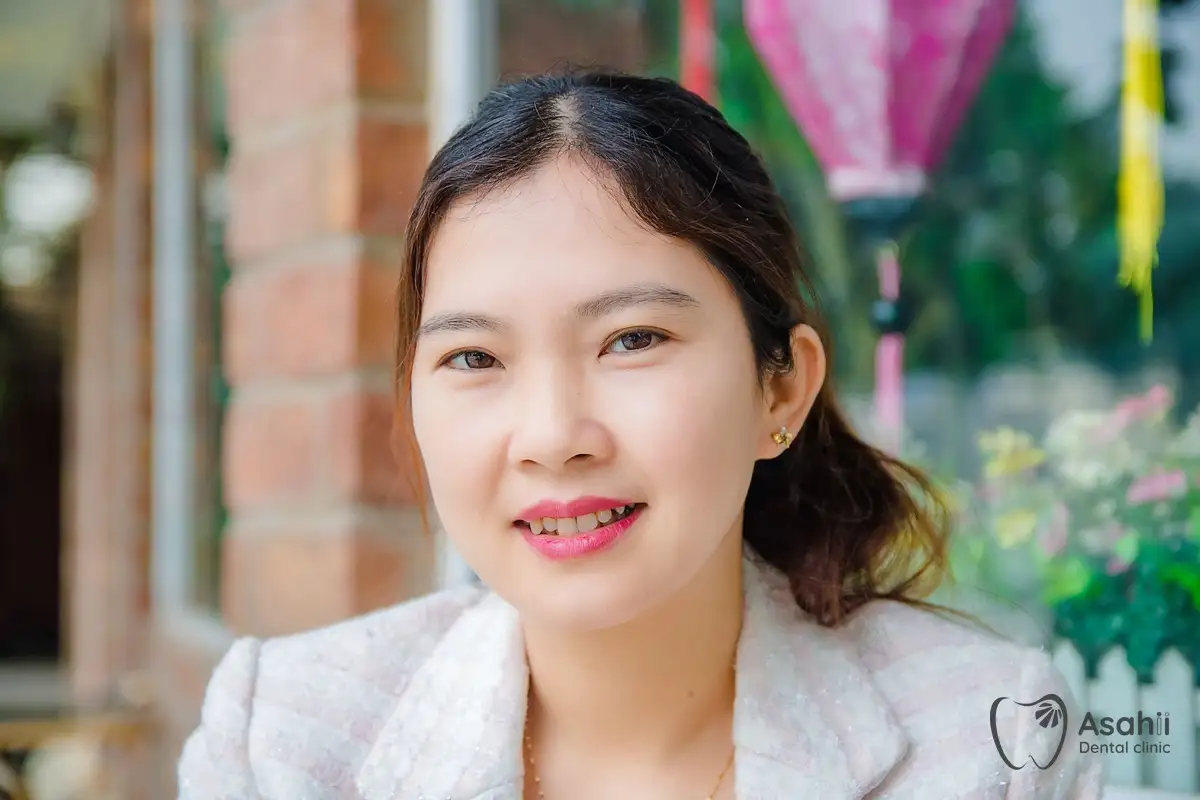 Keeping teeth white after whitening: cut down on coffee, tea and smoking, and brush regularly