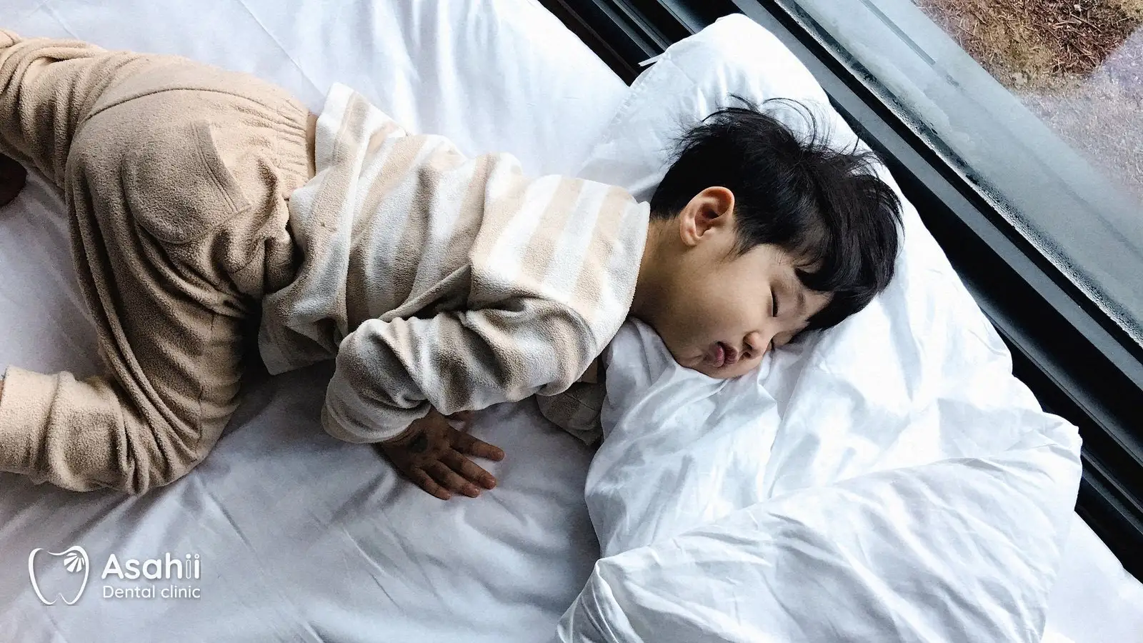 Trẻ ngủ ngáy hay thở bằng miệng nên được khám tai mũi họng trước, rồi theo dõi răng và hàm